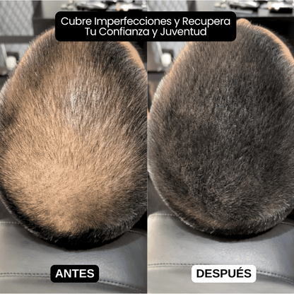 SCULPIX™ | EL RELLENO CAPILAR MÁS VENDIDO