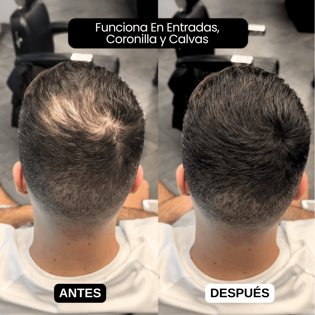 SCULPIX™ | EL RELLENO CAPILAR MÁS VENDIDO